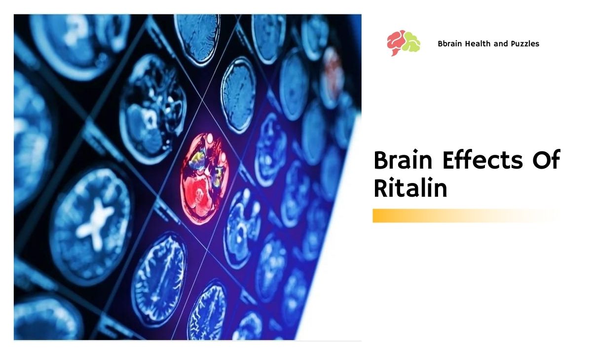 Brain Effects Of Ritalin