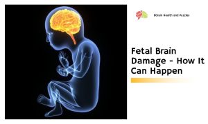 Fetal Brain Damage - How It Can Happen