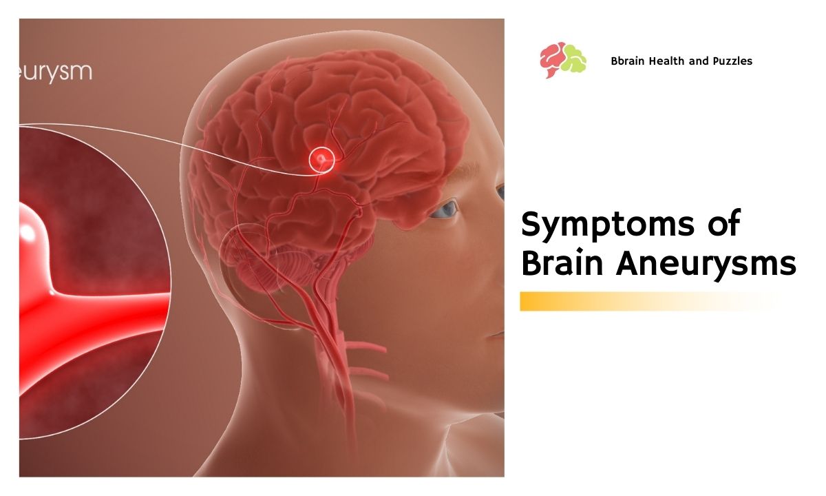 Symptoms of Brain Aneurysms