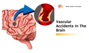 Vascular Accidents In The Brain