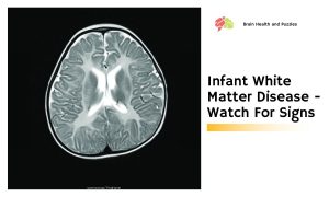 Infant White Matter Disease - Watch For Signs