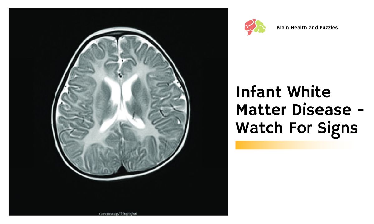 Infant White Matter Disease – Watch For Signs