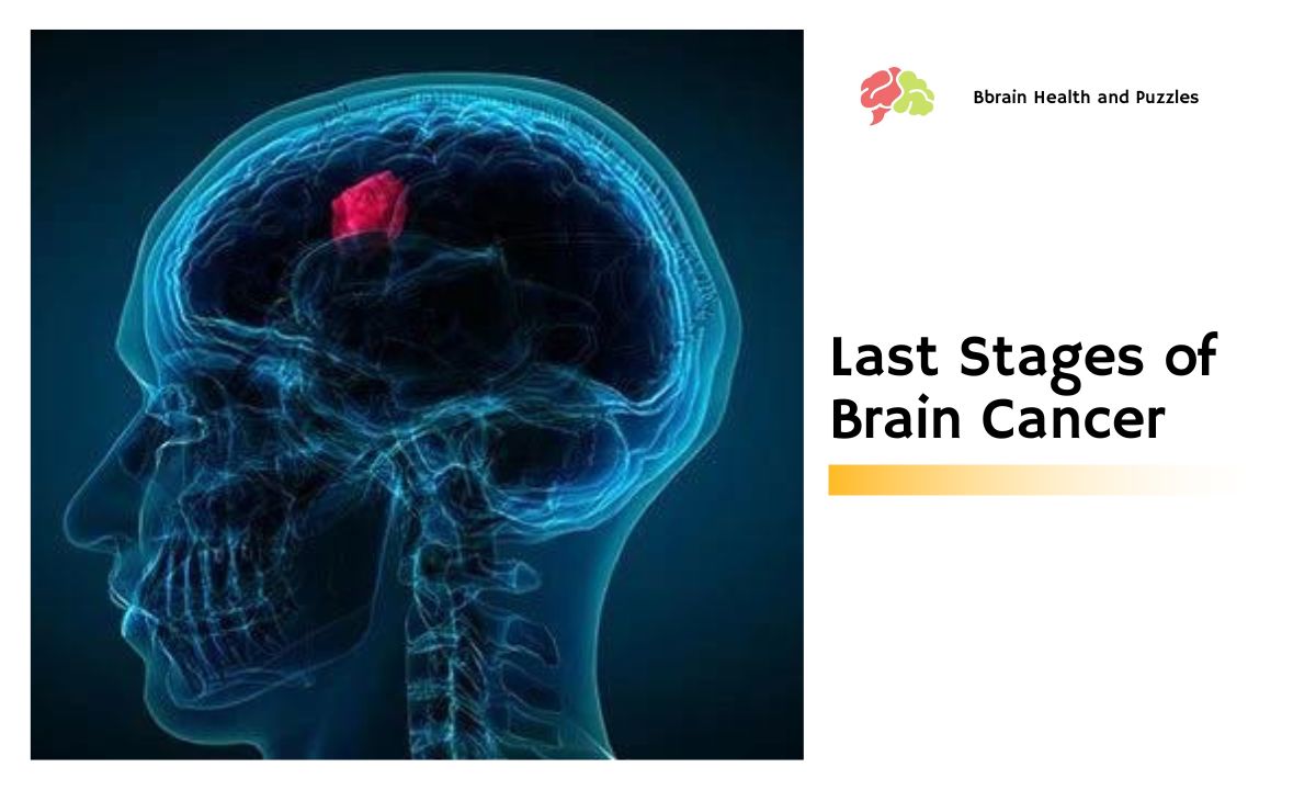 Last Stages of Brain Cancer - More Than Just a Headache