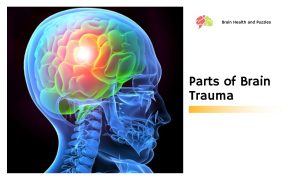 Parts of Brain Trauma