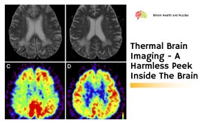 Thermal Brain Imaging - A Harmless Peek Inside The Brain