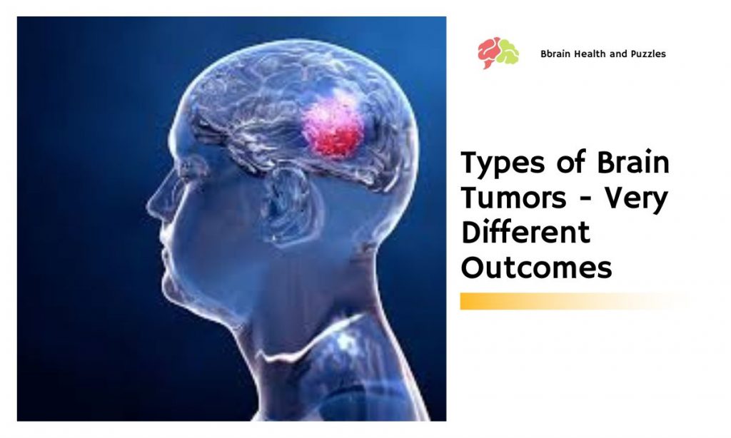 Types of Brain Tumors Very Different Brain Health and Puzzles