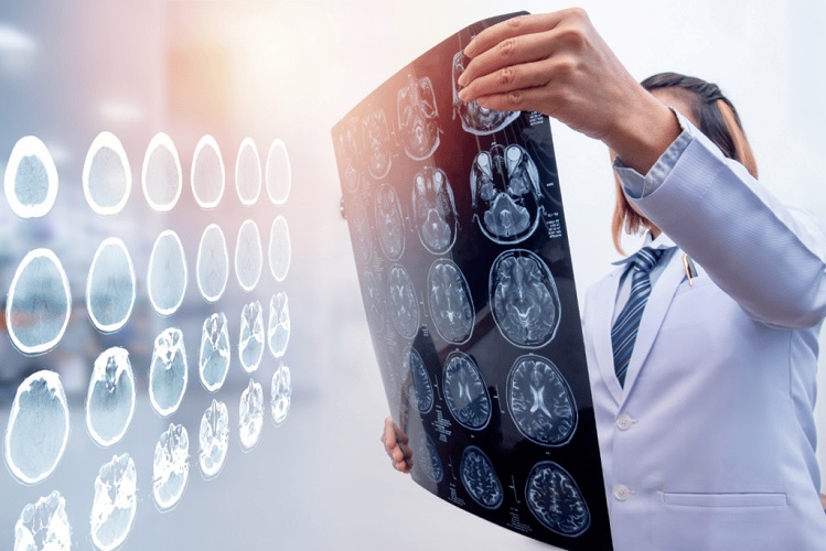 Hawaii Brain Injury Lawyers: Understanding Traumatic Brain Injury