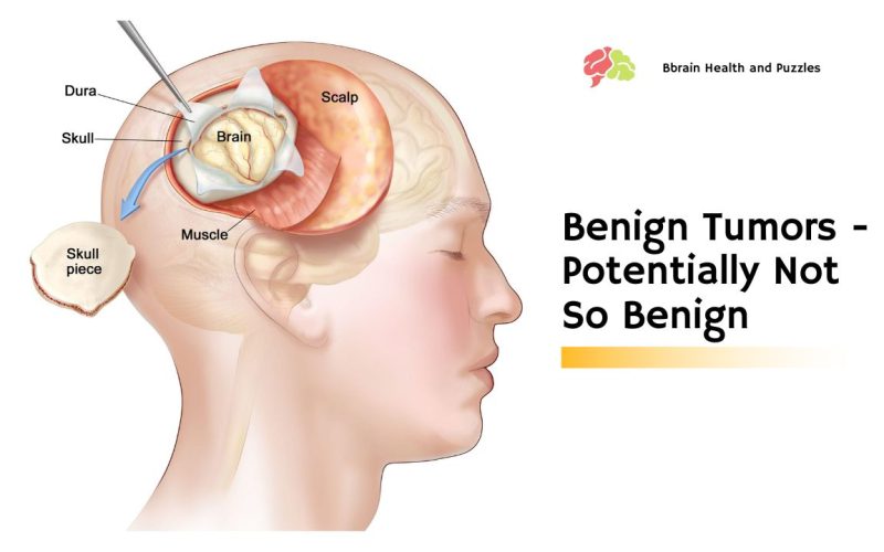 Benign Tumors – Potentially Not So Benign