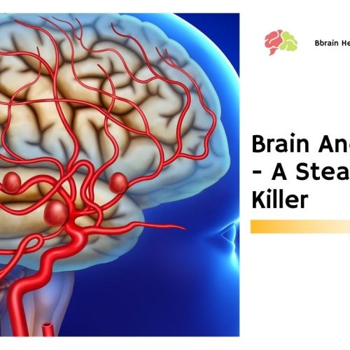 Brain Aneurysms – A Stealthy Killer