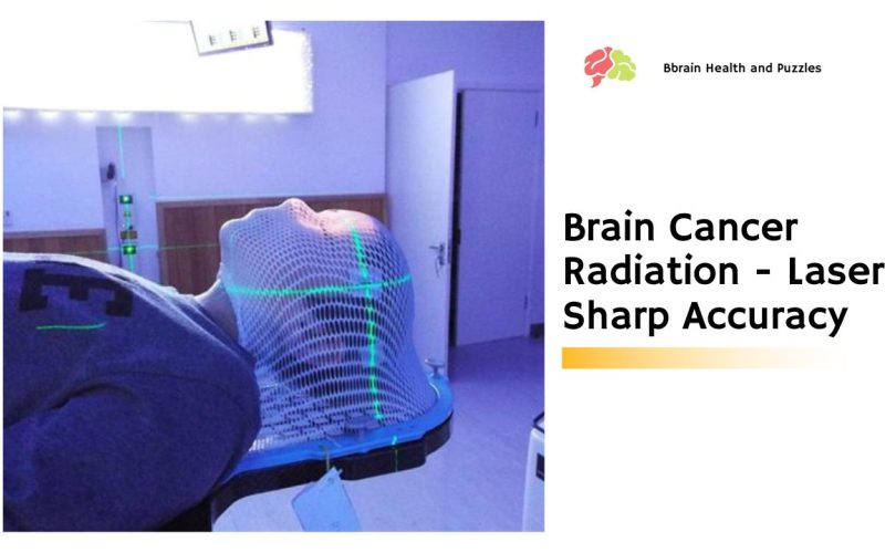 Brain Cancer Radiation – Laser Sharp Accuracy