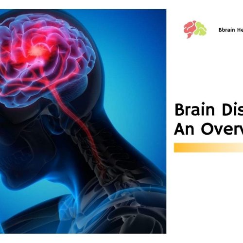 Brain Disease – An Overview