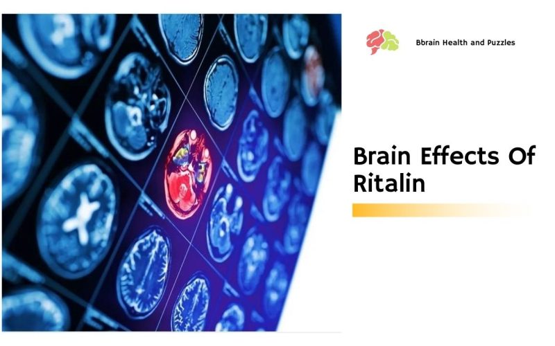 Brain Effects Of Ritalin