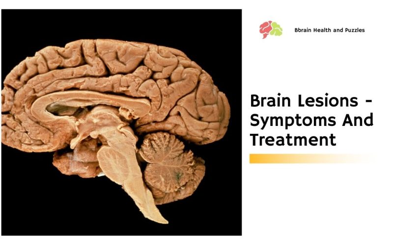 Brain Lesions – Symptoms And Treatment