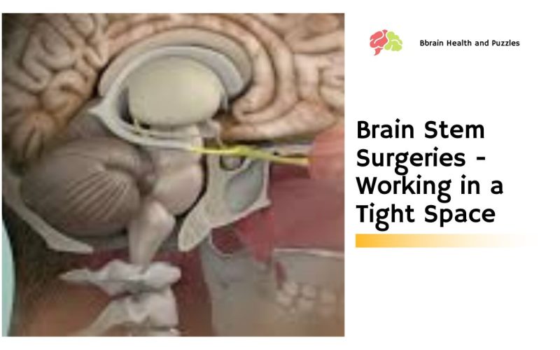 Brain Stem Surgeries – Working in a Tight Space