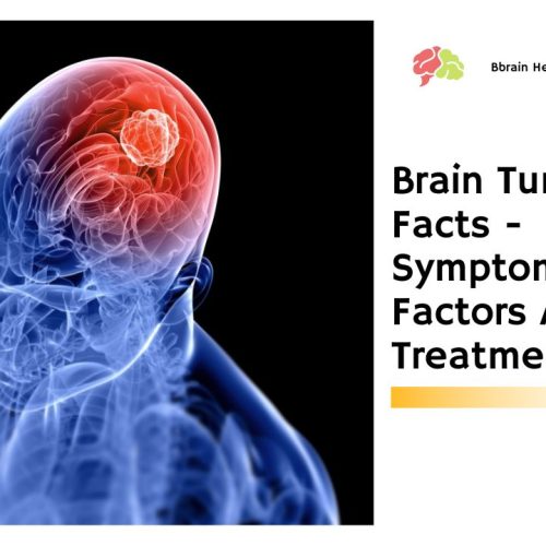Brain Tumor Facts – Symptoms, Risk Factors And Treatments