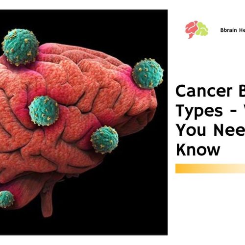 Cancer Brain Types – What You Need To Know