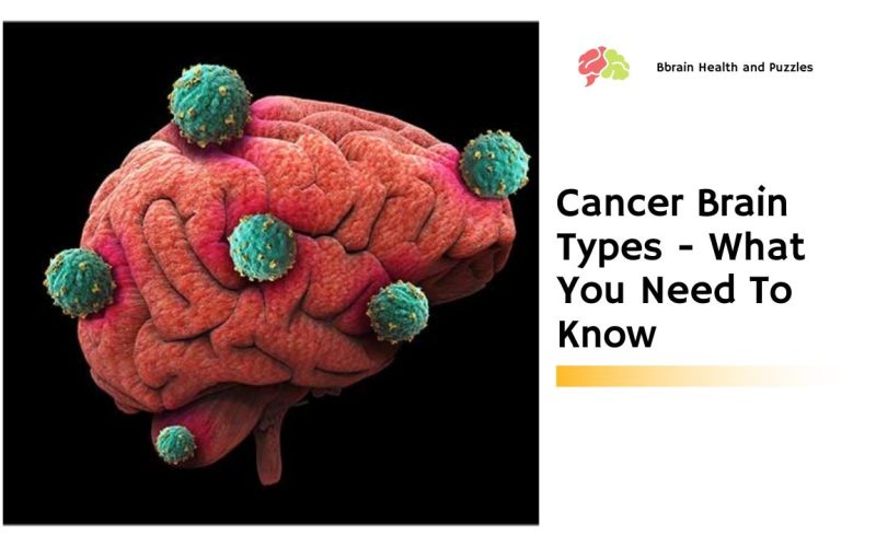 Cancer Brain Types – What You Need To Know