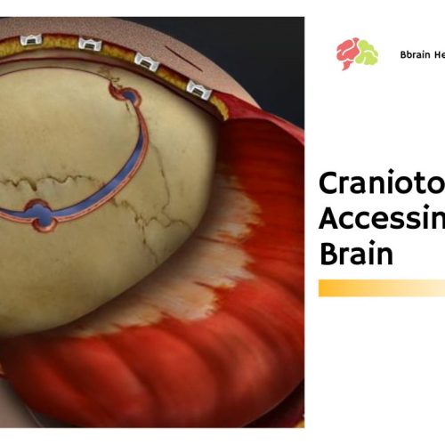 Craniotomy – Accessing The Brain