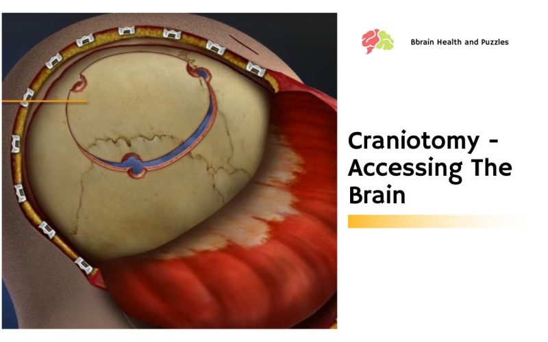 Craniotomy – Accessing The Brain