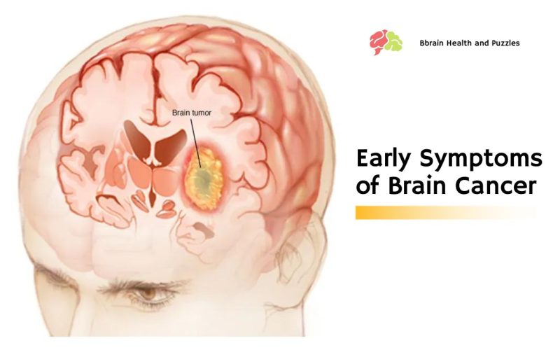Early Symptoms of Brain Cancer
