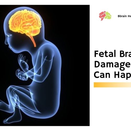 Fetal Brain Damage – How It Can Happen