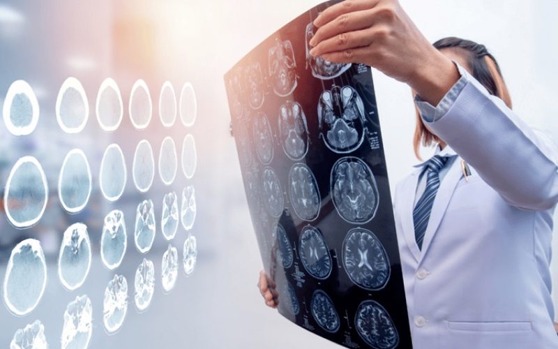 Hawaii Brain Injury Lawyers: Understanding Traumatic Brain Injury