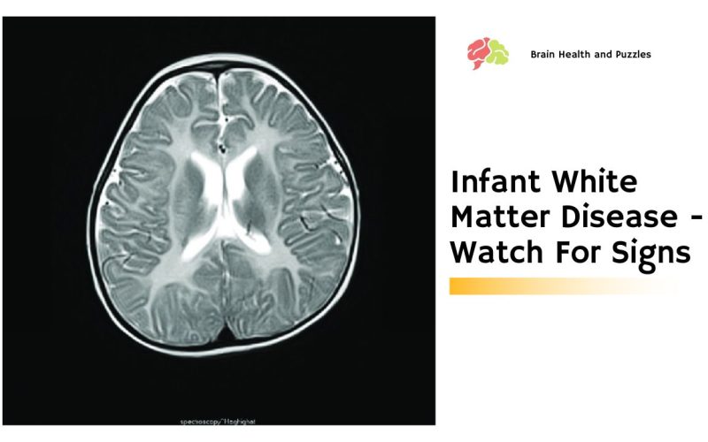 Infant White Matter Disease – Watch For Signs