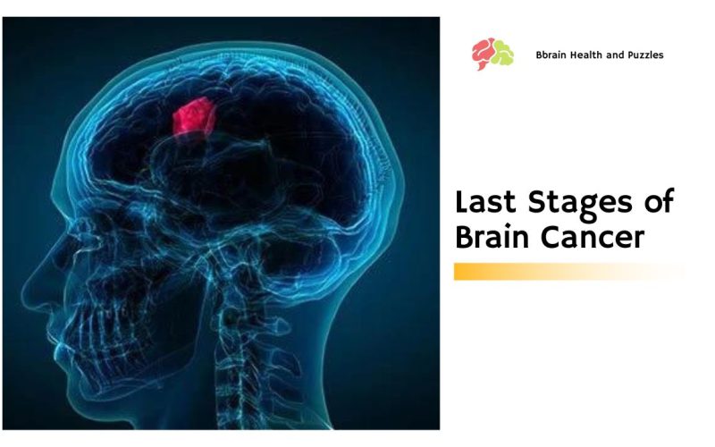 Last Stages of Brain Cancer – More Than Just a Headache