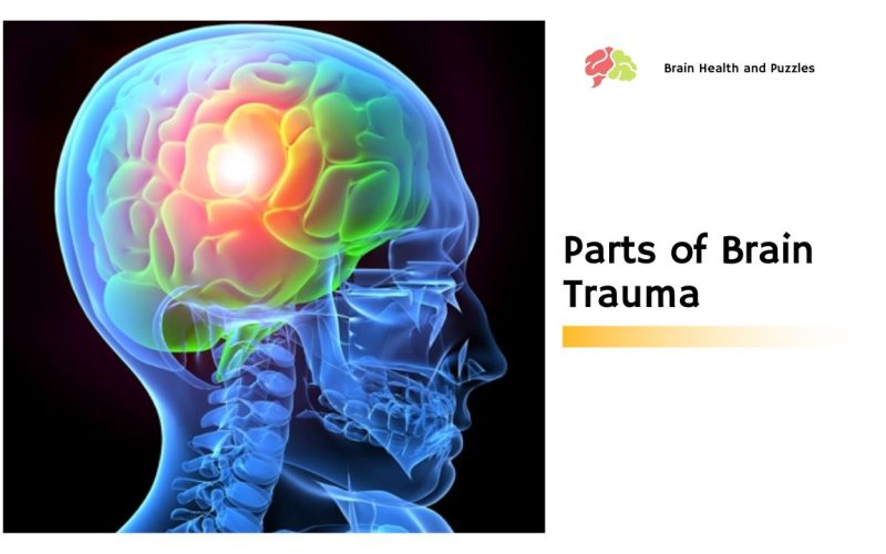 Parts of Brain Trauma
