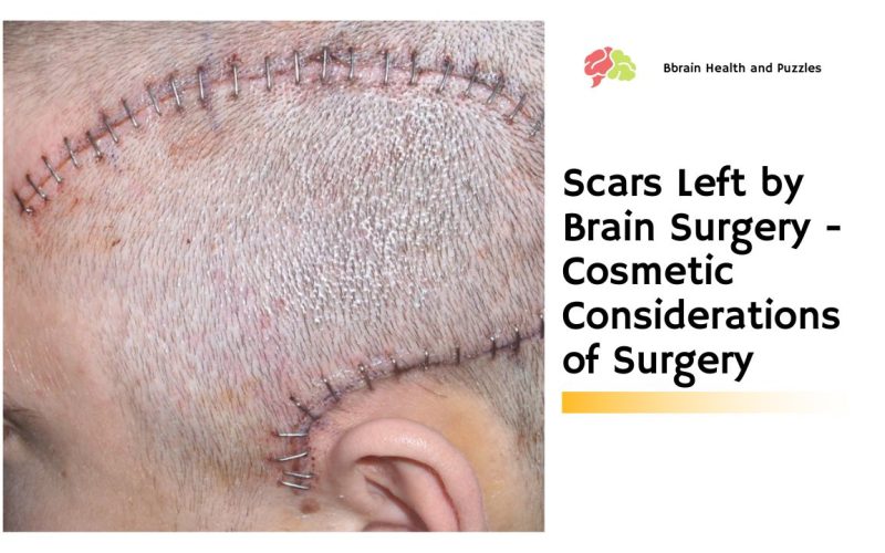 Scars Left by Brain Surgery – Cosmetic Considerations of Surgery
