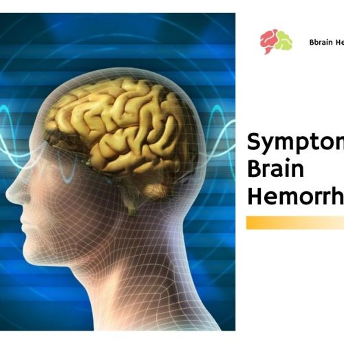 Symptoms of Brain Hemorrhage