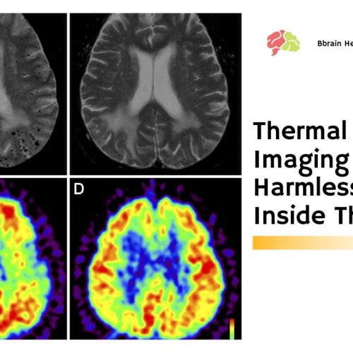 Thermal Brain Imaging – A Harmless Peek Inside The Brain