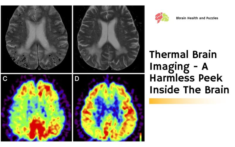 Thermal Brain Imaging – A Harmless Peek Inside The Brain