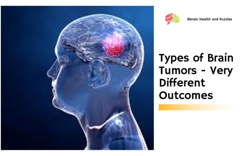 Types of Brain Tumors – Very Different Outcomes