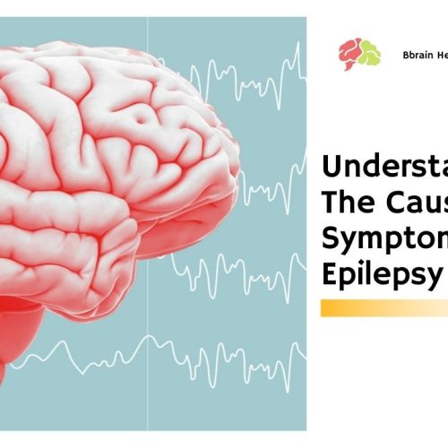 Understanding The Causes And Symptoms Of Epilepsy