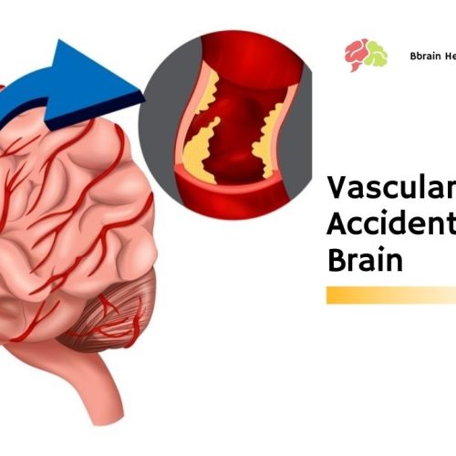 Vascular Accidents In The Brain