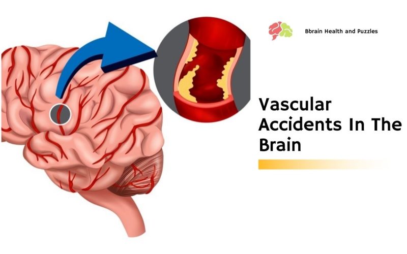 Vascular Accidents In The Brain