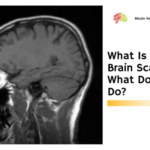 What Is An MRI Brain Scan And What Does It Do?