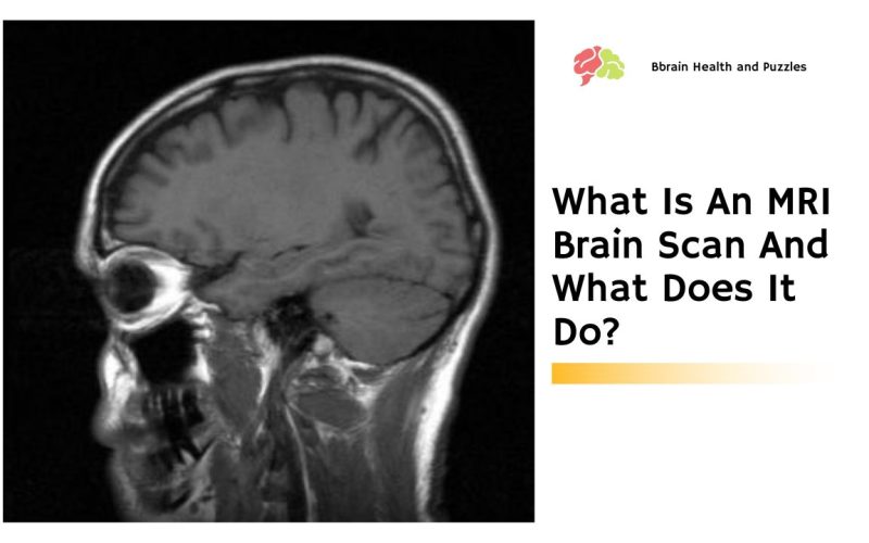 What Is An MRI Brain Scan And What Does It Do?