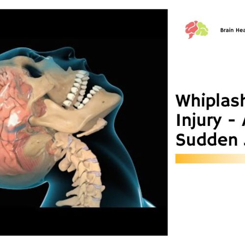 Whiplash Brain Injury – A Sudden Jolt